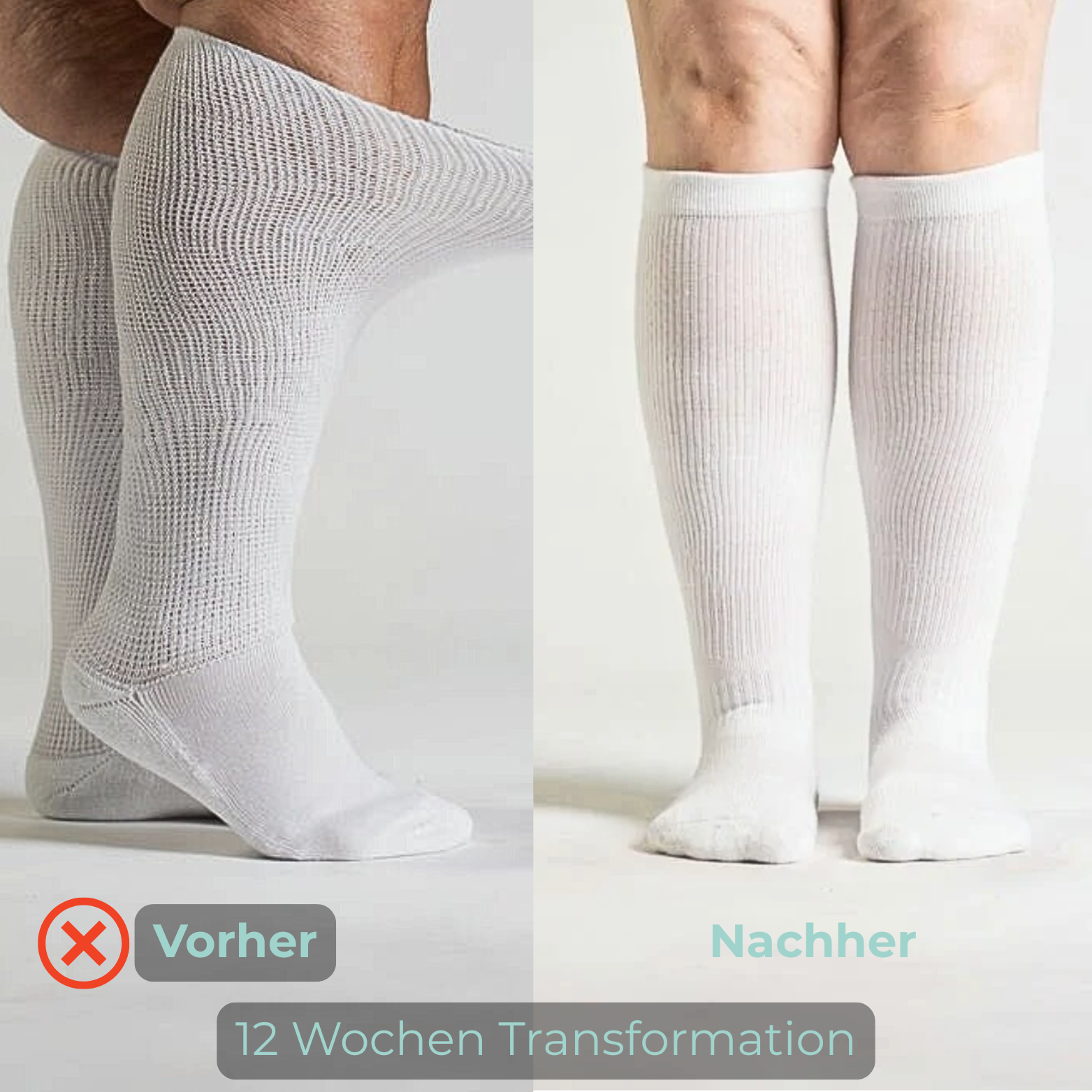 MoreStretch - Venen Socks